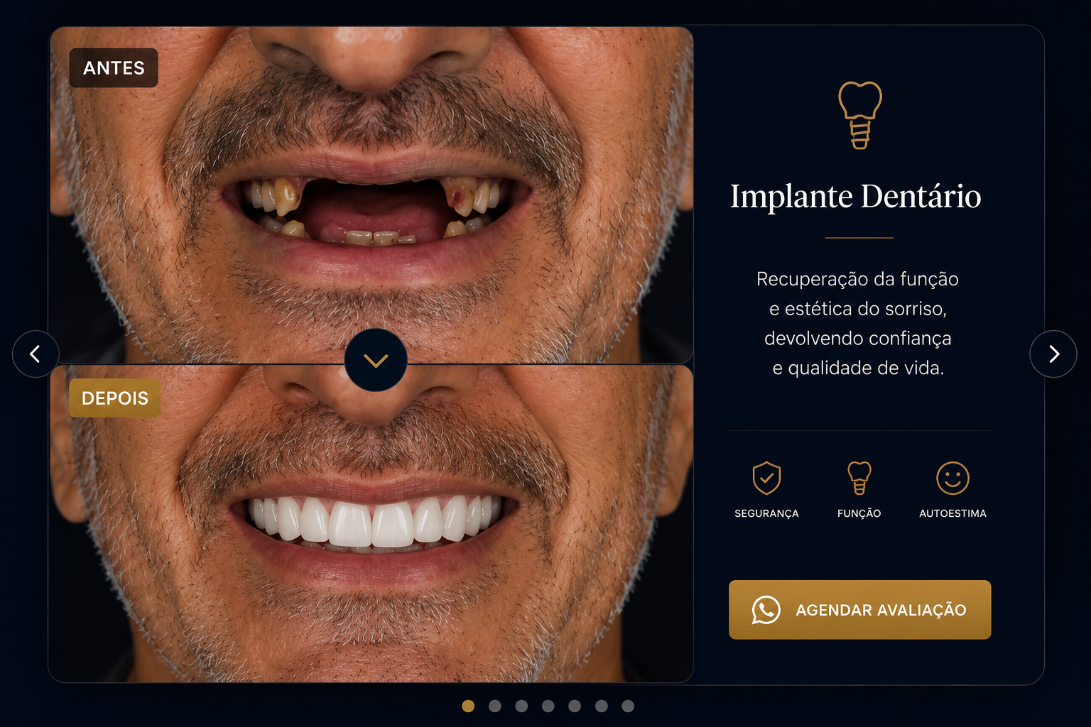 Antes e depois de implante dentário