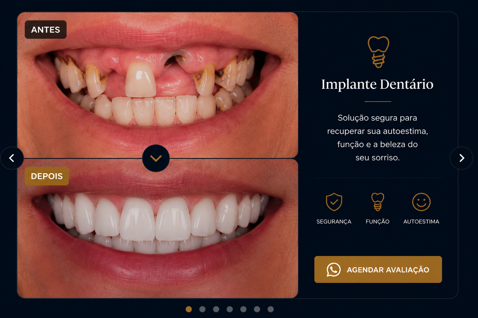 Antes e depois de reabilitação com implantes