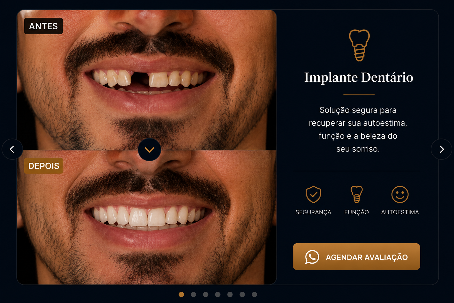 Antes e depois de reconstrução do sorriso