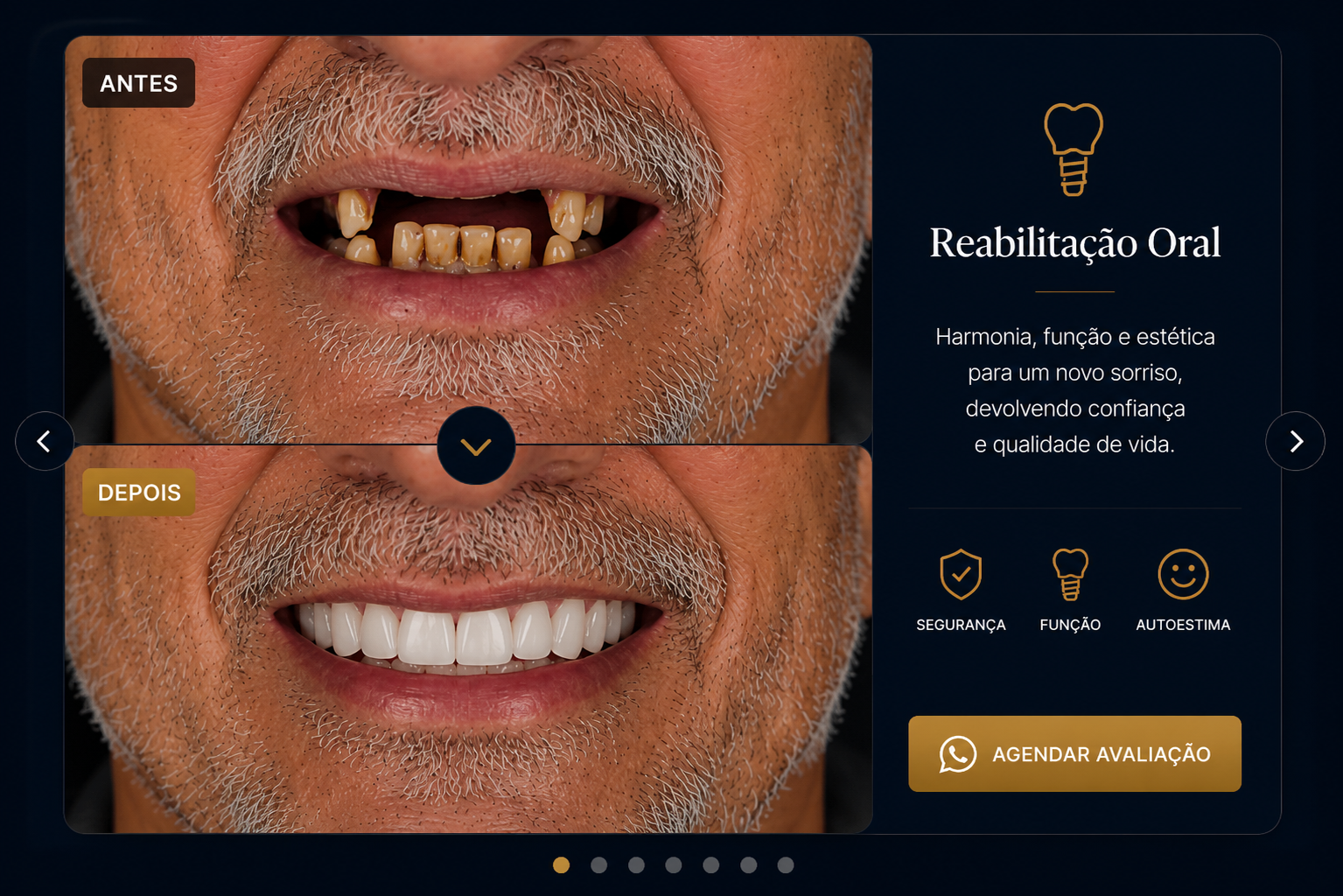 Antes e depois de reabilitação oral